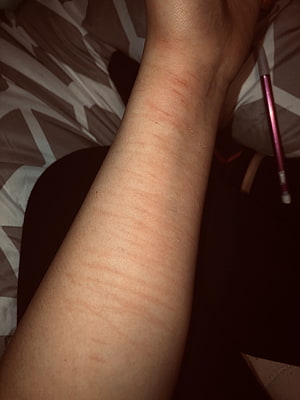 Close-up of human forearm with visible skin texture and faint red marks, Hand cutpinterest.ph, #hand cut HD phone wallpaper